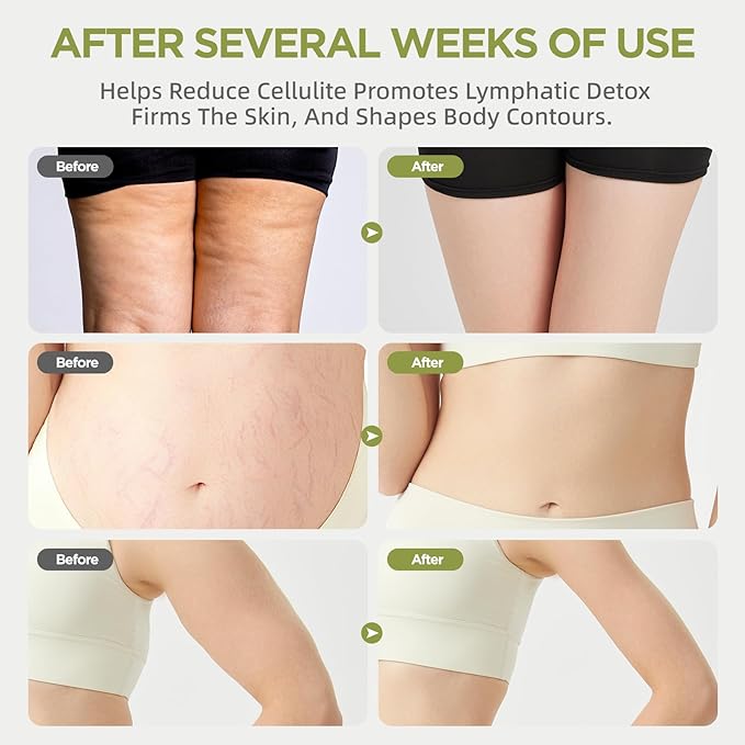 "Forma kroppen & reducera celluliter – Trådlös succé! 🔋🤩"