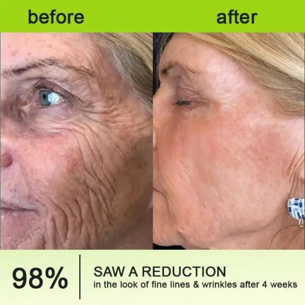 Botox & Vita-A Retinol Shot Wrinkle-Lift Tightening cream