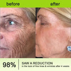 Botox & Vita-A Retinol Shot Wrinkle-Lift Tightening cream