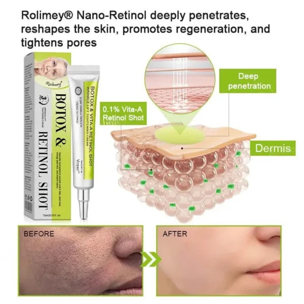 Botox & Vita-A Retinol Shot Wrinkle-Lift Tightening cream