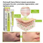 Botox & Vita-A Retinol Shot Wrinkle-Lift Tightening cream