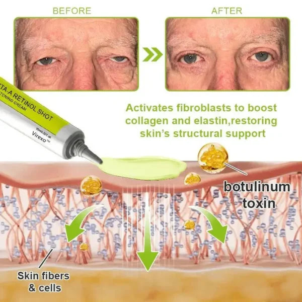 Botox & Vita-A Retinol Shot Wrinkle-Lift Tightening cream
