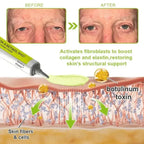 Botox & Vita-A Retinol Shot Wrinkle-Lift Tightening cream