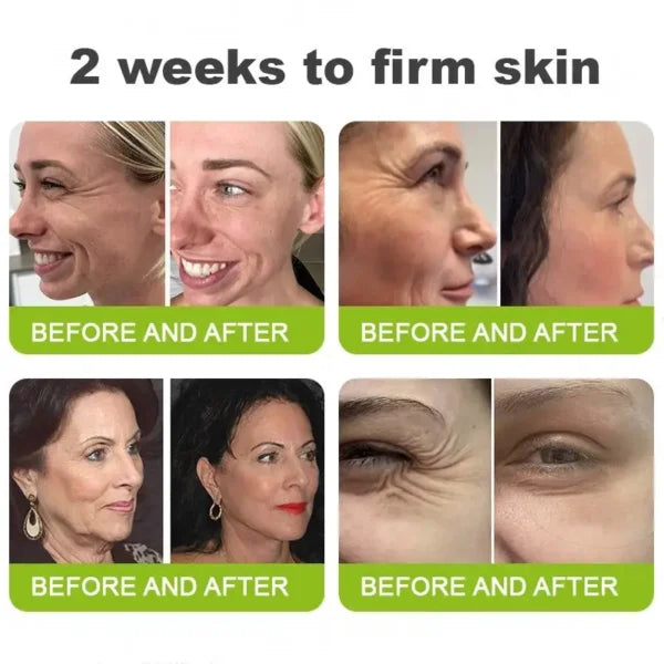 Botox & Vita-A Retinol Shot Wrinkle-Lift Tightening cream