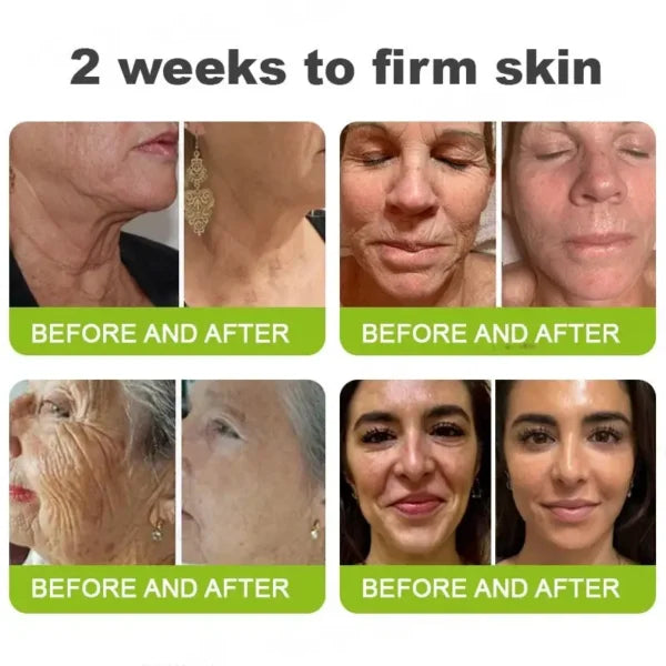 Botox & Vita-A Retinol Shot Wrinkle-Lift Tightening cream