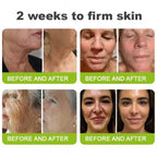 Botox & Vita-A Retinol Shot Wrinkle-Lift Tightening cream