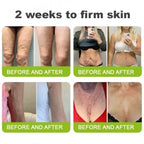 Botox & Vita-A Retinol Shot Wrinkle-Lift Tightening cream