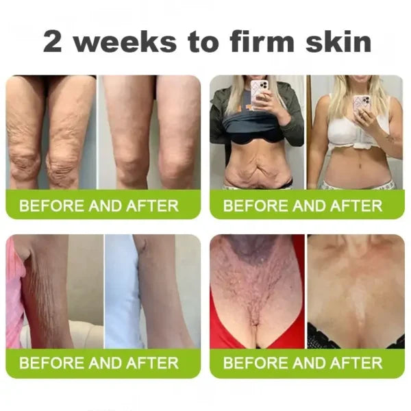 Botox & Vita-A Retinol Shot Wrinkle-Lift Tightening cream