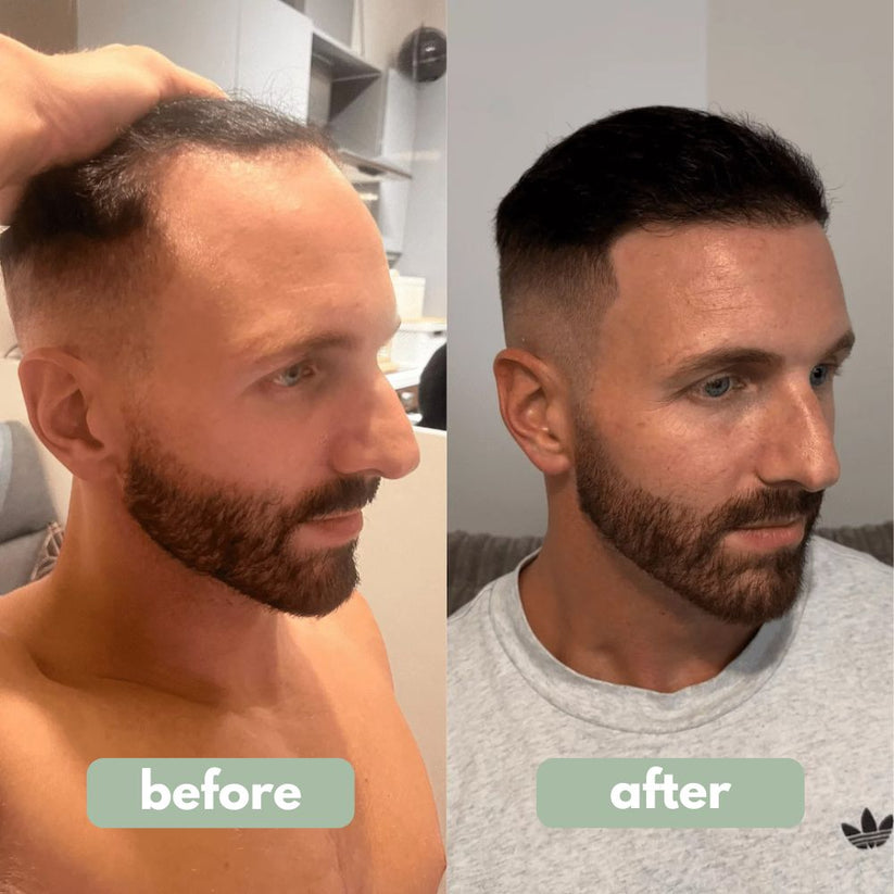✨💇‍♀️Få det fyldigere håret du alltid har drømt om