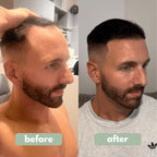 ✨💇‍♀️Få det fyldigere håret du alltid har drømt om